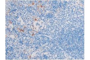 ABIN6255701 and ABIN6267554 at 1/200 staining Mouse spleen tissue sections by IHC-P. (LIM Domain Kinase 1 Antikörper  (pThr508))