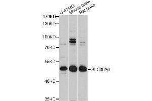 Western blot analysis of extracts of various cell lines, using SLC30A6 Antibody (ABIN4905198) at 1:3000 dilution. (SLC30A6 Antikörper)