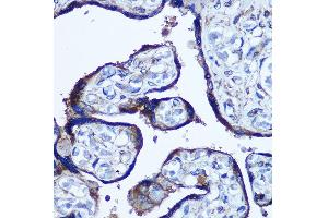 Immunohistochemistry of paraffin-embedded Human placenta using TBCCD1 Rabbit pAb (ABIN7270751) at dilution of 1:100 (40x lens). (TBCCD1 Antikörper)