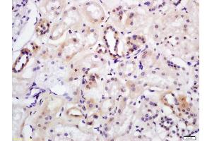 Immunohistochemistry (IHC) image for anti-Wingless-Type MMTV Integration Site Family, Member 7A (WNT7A) (AA 241-349) antibody (ABIN719336)