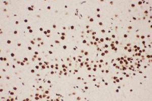 Anti-ALOX5 Picoband antibody,  IHC(P): Rat Brain Tissue (ALOX5 Antikörper  (AA 120-483))