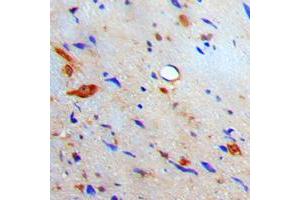 Immunohistochemical analysis of S100-A10 staining in human brain formalin fixed paraffin embedded tissue section. (S100A10 Antikörper  (Center))