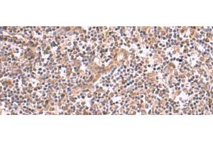 Immunohistochemistry of paraffin-embedded Human tonsil tissue using SLC12A7 Polyclonal Antibody at dilution of 1:50(x200)