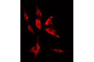 ABIN6274998 staining LOVO cells by IF/ICC. (CLN5 Antikörper  (Internal Region))