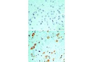 Immunohistochemical analysis of TLR5 in formalin-fixed, paraffin-embedded mouse brain tissue using an isotype control (top) and TLR5 monoclonal antibody, clone 19D759.
