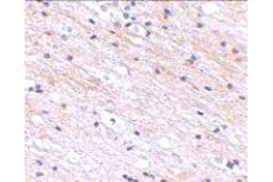 Immunohistochemical staining of human brain tissue with 2. (SATB1 Antikörper  (N-Term))