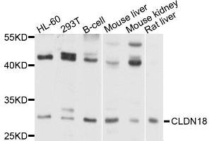 Western blot analysis of extract of various cells, using CLDN18 antibody. (Claudin 18 Antikörper)