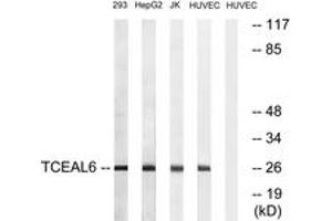 Western blot analysis of extracts from HuvEc/293/HepG2/Jurkat cells, using TCEAL6 Antibody.
