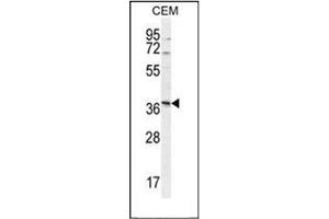Western blot analysis of Neurexophilin-4 Antibody (C-term) in CEM cell line lysates (35ug/lane).