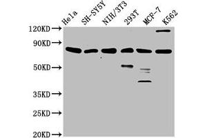 Western Blot Positive WB detected in: Hela whole cell lysate, SH-SY5Y whole cell lysate, NIH/3T3 whole cell lysate, 293T whole cell lysate, MCF-7 whole cell lysate, K562 whole cell lysate All lanes: KMT2E antibody at 3. (MLL5/KMT2E Antikörper  (AA 182-316))