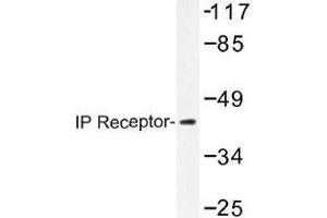 Image no. 1 for anti-Prostacyclin Receptor (PTGIR) antibody (ABIN317863) (Prostacyclin Receptor Antikörper)