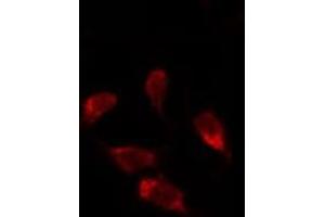 ABIN6278125 staining Hela by IF/ICC. (UNG Antikörper  (Internal Region))