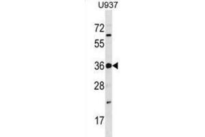 Western Blotting (WB) image for anti-TP53 Regulating Kinase (TP53RK) antibody (ABIN3003681) (TP53RK Antikörper)