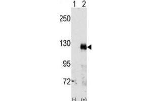 Western Blotting (WB) image for anti-EPH Receptor A3 (EPHA3) antibody (ABIN3003329) (EPH Receptor A3 Antikörper)