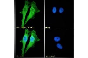 (ABIN302164) Immunofluorescence analysis of paraformaldehyde fixed HeLa cells, permeabilized with 0. (ABCC11 Antikörper  (Internal Region))