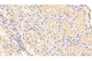 Immunohistochemistry (IHC) image for anti-Matrix Metallopeptidase 7 (Matrilysin, Uterine) (MMP7) (AA 18-267) antibody (ABIN7425686)