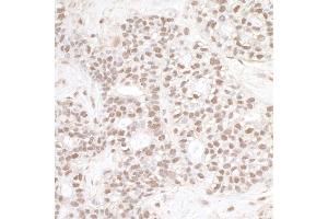 anti-DNA Repair Protein Complementing XP-B Cells (ERCC3) (AA 575-625) antibody