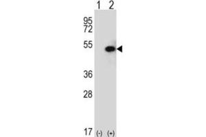 Western Blotting (WB) image for anti-Sphingosine Kinase 1 (SPHK1) antibody (ABIN2995255) (SPHK1 Antikörper)