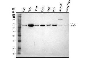 Western blot analysis of SOCS5 using anti-SOCS5 antibody (ABIN7601562). (SOCS5 Antikörper  (AA 386-536))