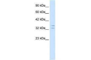 Human Jurkat; WB Suggested Anti-POU1F1 Antibody Titration: 1. (POU1F1 Antikörper  (N-Term))