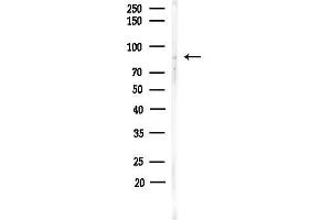 Western blot analysis of lysates from MDA-MB-231 cells(heat-shock,45 min treatment), using APPL1 Antibody at 1/1000 dilution.