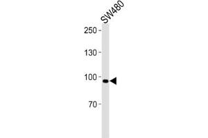 Western Blotting (WB) image for anti-Anoctamin 6 (ANO6) antibody (ABIN3001398) (Anoctamin 6 Antikörper)