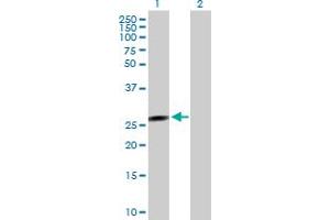 Western Blot analysis of FLJ37201 expression in transfected 293T cell line by FLJ37201 MaxPab polyclonal antibody. (FLJ37201 Antikörper  (AA 1-199))