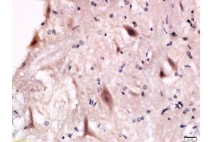 Formalin-fixed and paraffin embedded rat anterior horn of spinal cord labeled with Anti-P2Y12 Polyclonal Antibody, Unconjugated  at 1:200 followed by conjugation to the secondary antibody and DAB staining. (P2RY12 Antikörper  (AA 141-240))