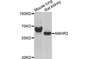 Western blot analysis of extracts of various cell lines, using AMHR2 antibody (ABIN2561084) at 1:1000 dilution. (AMHR2 Antikörper)