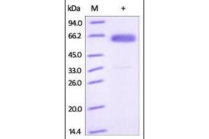 SDS-PAGE (SDS) image for Frizzled Family Receptor 4 (FZD4) (AA 37-180) protein (Fc Tag) (ABIN2181126) (FZD4 Protein (AA 37-180) (Fc Tag))