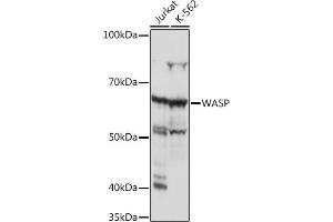 Western blot analysis of extracts of various cell lines, using WASP Rabbit mAb (ABIN7271381) at 1:1000 dilution. (WASP Antikörper)