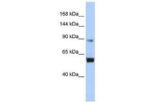 WB Suggested Anti-MCM10  Antibody Titration: 0. (MCM10 Antikörper  (Middle Region))