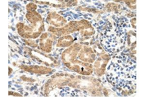 GMPPB antibody was used for immunohistochemistry at a concentration of 4-8 ug/ml to stain Epithelial cells of renal tubule (arrows) in Human Kidney.