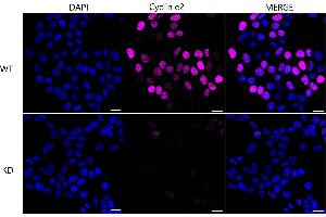 Immunocytochemical staining of HeLa cells using Cyclin e2 antibody (ABIN7798199), 1:1,000), Top panel: wild-type (WT), Bottom panal: Cyclin e2 shRNA knockdown (KD). (Rekombinanter Cyclin E2 Antikörper)