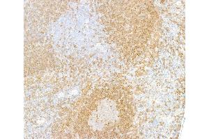 Immunohistochemistry (IHC) image for anti-B-cell antigen receptor complex-associated protein alpha chain (CD79A) (AA 176-226) antibody (ABIN7454005)