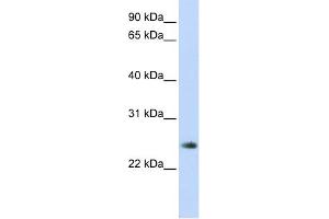 WB Suggested Anti-THYN1 Antibody Titration: 0. (THYN1 Antikörper  (Middle Region))