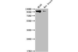 Western Blot Positive WB detected in: HL60 whole cell lysate, Rat brain tissue All lanes: DNM2 antibody at 1:2000 Secondary Goat polyclonal to rabbit IgG at 1/50000 dilution Predicted band size: 99, 98 kDa Observed band size: 99 kDa (Rekombinanter DNM2 Antikörper)