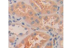 Used in DAB staining on fromalin fixed paraffin- embedded Kidney tissue (ARL15 Antikörper  (AA 1-204))