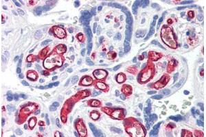 Human Placenta (formalin-fixed, paraffin-embedded) stained with CD34 antibody ABIN337371 at 10 ug/ml followed by biotinylated anti-mouse IgG secondary antibody ABIN481714, alkaline phosphatase-streptavidin and chromogen. (CD34 Antikörper)