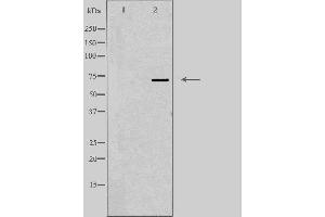 Western blot analysis of extracts from Jurkat cells using FSHR antibody.