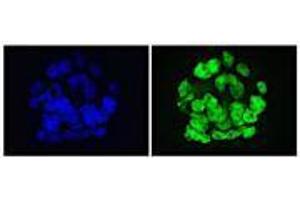 GLIS1 antibody (mAb) tested by Immunofluorescence.