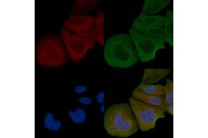 ABIN6258384 and ABIN6274981 staining Hela cells by IF/ICC. (CDC42EP4 Antikörper  (Internal Region))