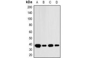 Western blot analysis of IDH3 alpha expression in MCF7 (A), HT29 (B), mouse brain (C), mouse kidney (D) whole cell lysates. (IDH3A Antikörper)