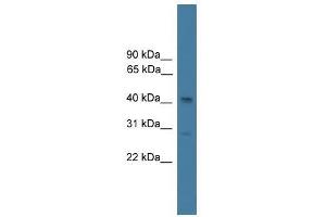 Western Blotting (WB) image for anti-serpin Peptidase Inhibitor, Clade B (Ovalbumin), Member 7 (SERPINB7) (N-Term) antibody (ABIN929173)