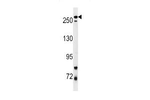 Park8 (LRRK2) Antibody  f western blot analysis in mouse lung tissue lysates (35 μg/lane). (LRRK2 Antikörper  (AA 878-909))