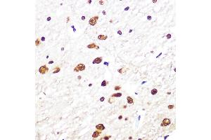 Immunohistochemistry of paraffin-embedded rat brain using SRSF1/SRSF1/SF2/ASF Rabbit mAb (ABIN7270213) at dilution of 1:100 (40x lens). (SRSF1 Antikörper)