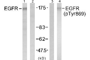 Western blot analysis of extracts from A431 cells untreated or treated with EGF (40μM, 10min), using EGFR (Ab-869) antibody (Linand 2) and EGFR (phospho- Tyr869) antibody (Line 3 and 4).