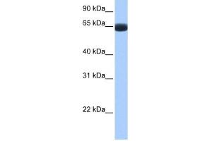ARHGAP28 antibody used at 1 ug/ml to detect target protein. (ARHGAP28 Antikörper  (C-Term))