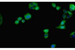 Immunofluorescent analysis of HepG2 cells using ABIN7156203 at dilution of 1:100 and Alexa Fluor 488-congugated AffiniPure Goat Anti-Rabbit IgG(H+L) (Indian Hedgehog Antikörper  (AA 203-411))