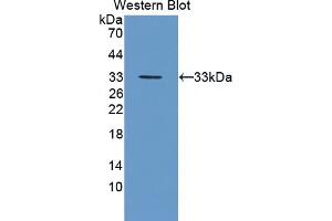 Western blot analysis of the recombinant protein. (FES Antikörper  (AA 510-770))